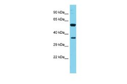 FAM49A Rabbit anti-Human, Polyclonal, Novus Biologicals 0.1ml; Unconjugated:Antibodies,